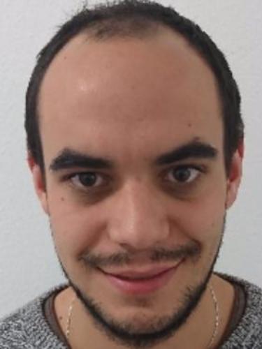 Kilian Skalet